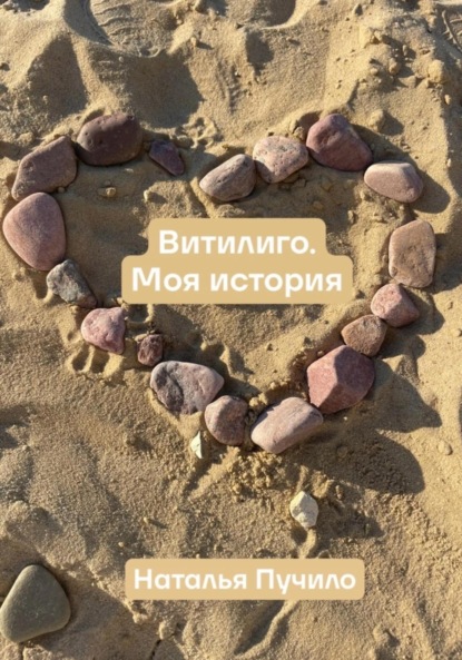 Витилиго. Моя история