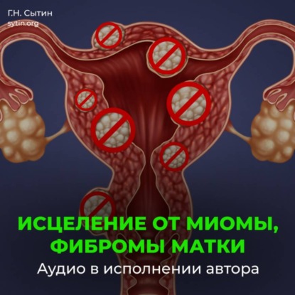 Исцеление от миомы, фибромы матки