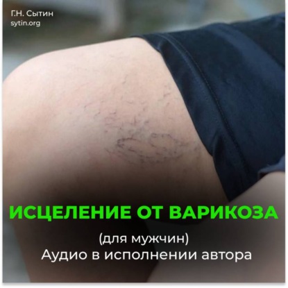 Исцеление от варикоза. Здоровые ноги. Исцеление от отека ног (для мужчин)