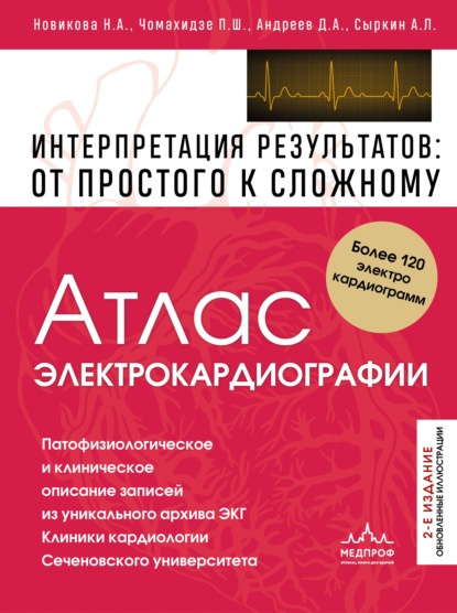 Атлас электрокардиографии. Интерпретация результатов: от простого к сложному. 2-е издание