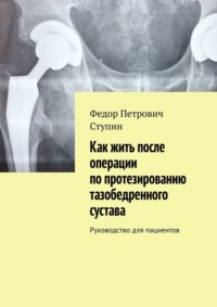 Как жить после операции по протезированию тазобедренного сустава. Руководство для пациентов