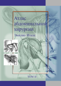 Атлас абдоминальной хирургии. Том 2. Хирургия желудка и двенадцатиперстной кишки