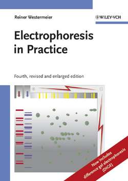 Electrophoresis in Practice